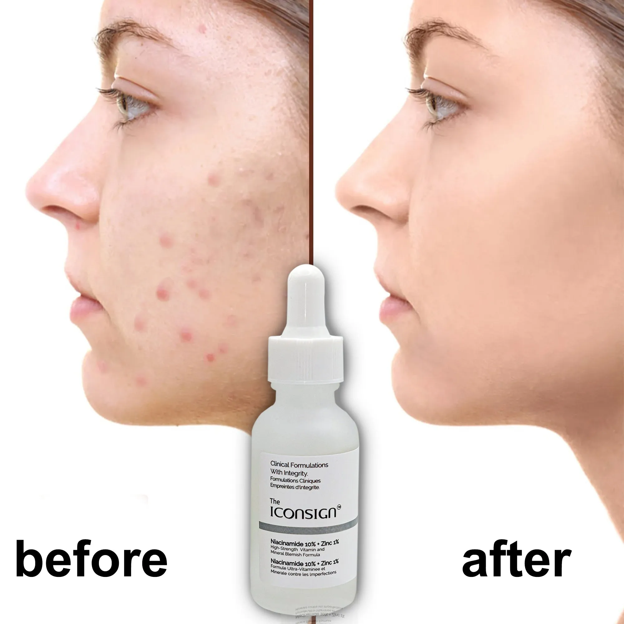 Best Face Serum – Vitamin C & Niacinamide for Glowing Skin | Iconsign UAE